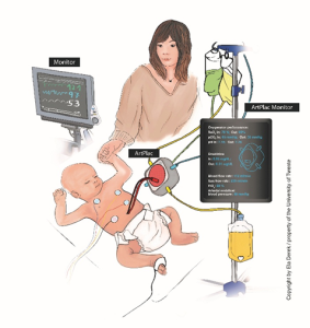 Art Plac illustration artificial placenta for newborn